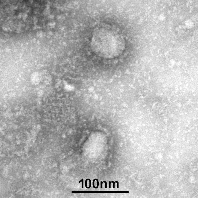 Công bố hình ảnh đầu tiên về virus corona